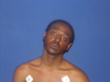MugShot